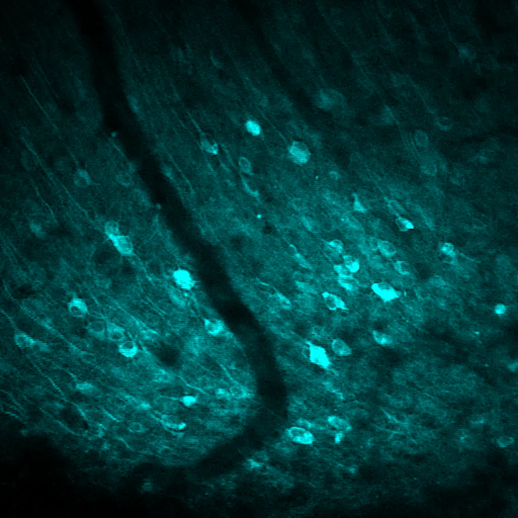 Neurons in mouse medial prefrontal cortex glowing cyan with the calcium indicator GCaMP8m